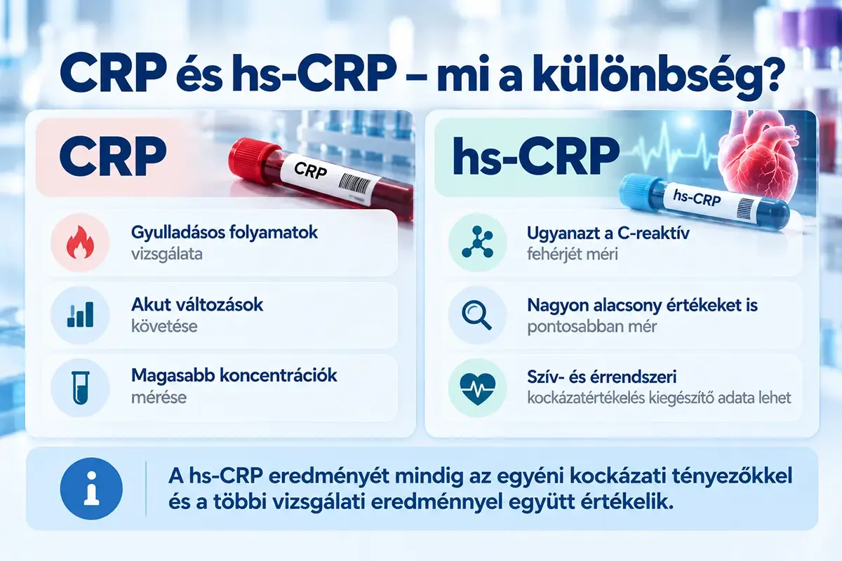 Infografika a CRP és a hs-CRP közötti különbségekről, a gyulladás vizsgálatától a szív- és érrendszeri kockázatbecslésig.
